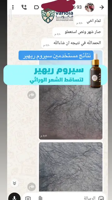 لقطة شاشة واتساب من تجربة عميل رقم 53
