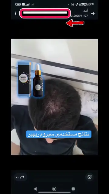 لقطة شاشة واتساب من تجربة عميل رقم 40