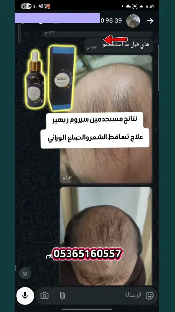 لقطة شاشة واتساب من تجربة عميل رقم 30