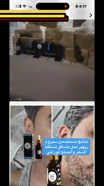 لقطة شاشة واتساب من تجربة عميل رقم 49