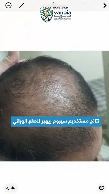 لقطة شاشة واتساب من تجربة عميل رقم 14