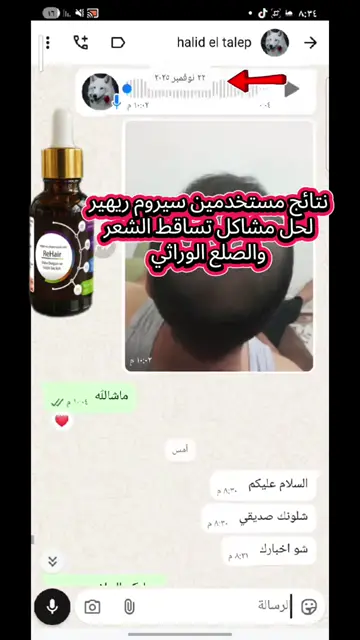 لقطة شاشة واتساب من تجربة عميل رقم 24