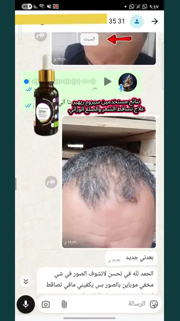لقطة شاشة واتساب من تجربة عميل رقم 20