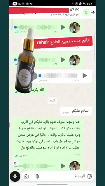 لقطة شاشة واتساب من تجربة عميل رقم 44