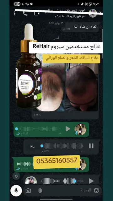 لقطة شاشة واتساب من تجربة عميل رقم 13