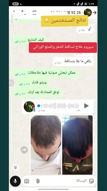 لقطة شاشة واتساب من تجربة عميل رقم 51