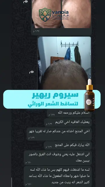 لقطة شاشة واتساب من تجربة عميل رقم 16