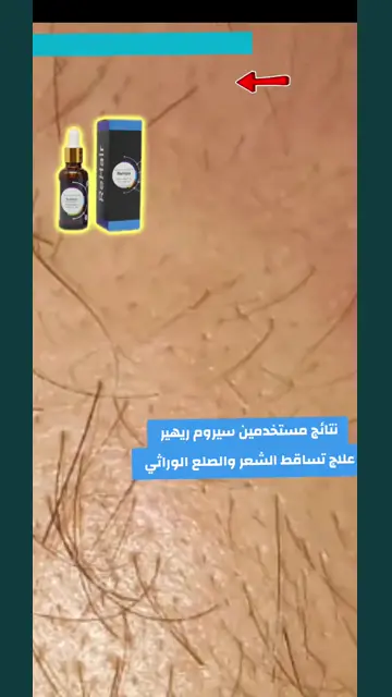 لقطة شاشة واتساب من تجربة عميل رقم 41