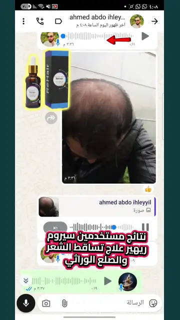 لقطة شاشة واتساب من تجربة عميل رقم 21