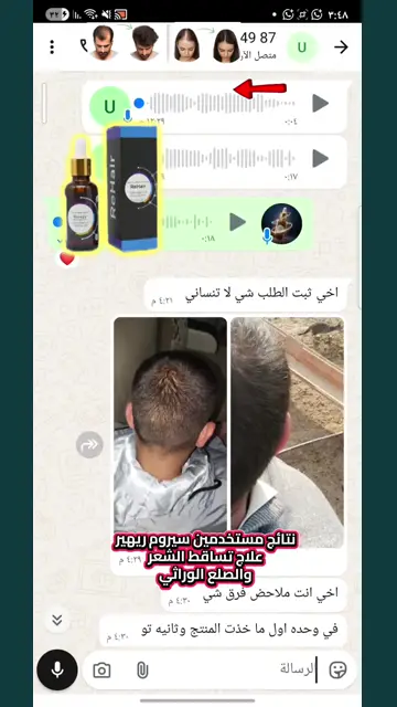 لقطة شاشة واتساب من تجربة عميل رقم 32