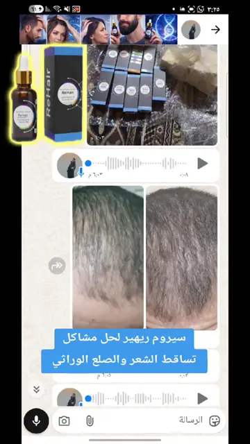 لقطة شاشة واتساب من تجربة عميل رقم 47