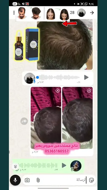 لقطة شاشة واتساب من تجربة عميل رقم 45