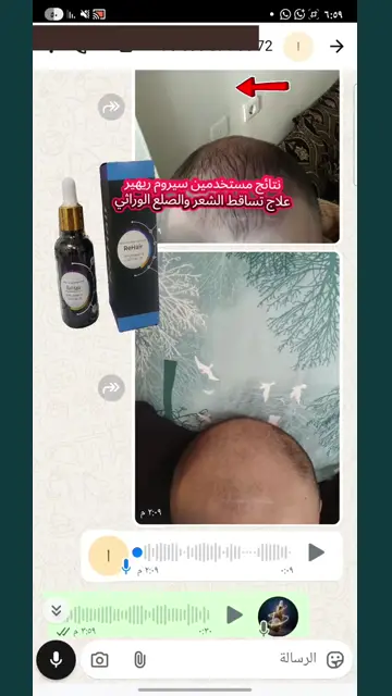 لقطة شاشة واتساب من تجربة عميل رقم 4