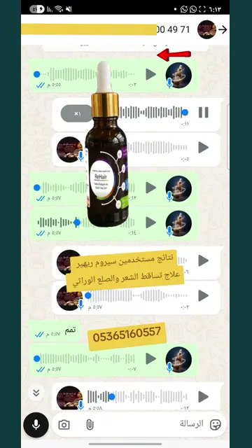 لقطة شاشة واتساب من تجربة عميل رقم 37