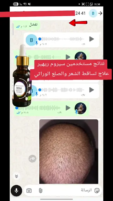 لقطة شاشة واتساب من تجربة عميل رقم 35