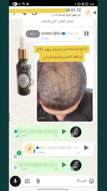 لقطة شاشة واتساب من تجربة عميل رقم 11