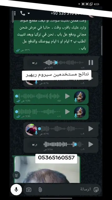 لقطة شاشة واتساب من تجربة عميل رقم 12