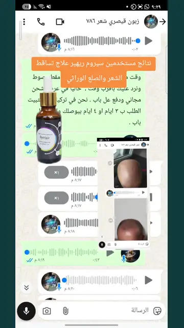 لقطة شاشة واتساب من تجربة عميل رقم 52